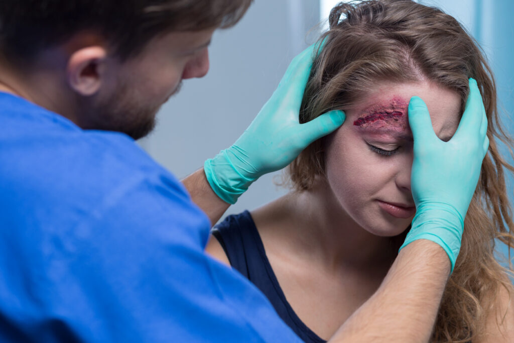 Facial Injury Lawyer in Baton Rouge & Lake Charles